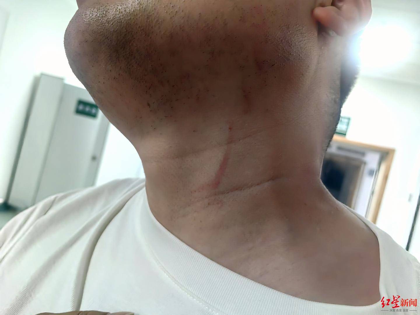 皇冠信用网如何注册
_武汉男子拍摄违停时被当街殴打皇冠信用网如何注册
，打人者被罚款500元，被打者称将提起行政复议并起诉