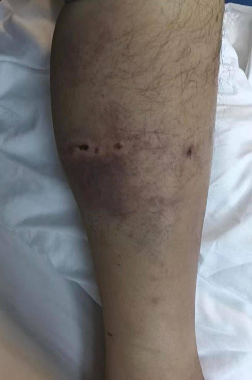 皇冠信用平台出租_重庆一男子上山采菌后遇熊袭击皇冠信用平台出租，幸亏穿了雨靴！20余名村民连夜救援