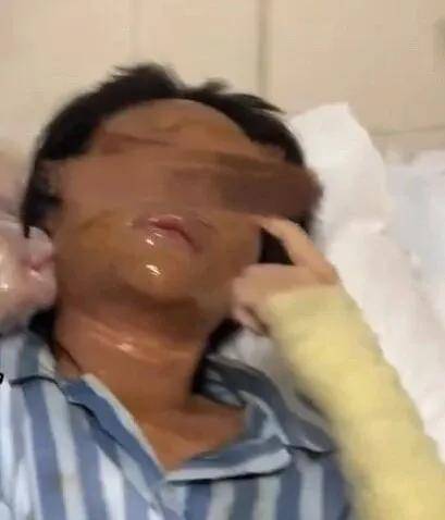 皇冠信用網网址
_女主播称遭伪装快递包裹炸伤皇冠信用網网址
，湖南警方通报