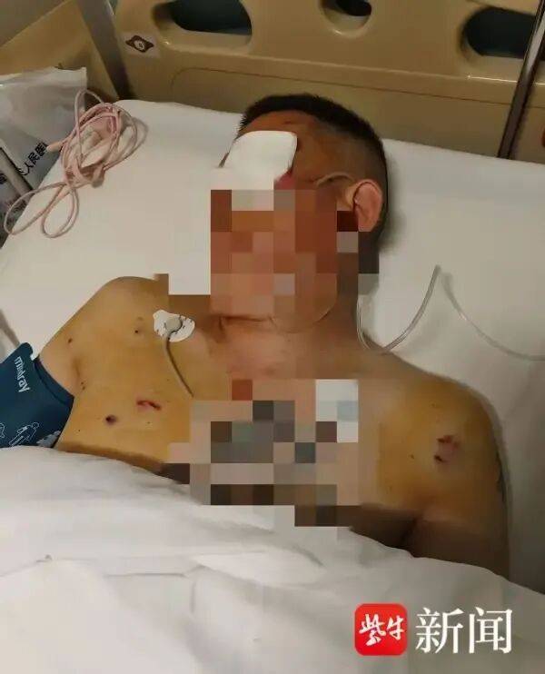 体斯輀必箭v克拉门扞国王
_男子取170万元现金银行门口遭抢体斯輀必箭v克拉门扞国王
,工作人员无动于衷