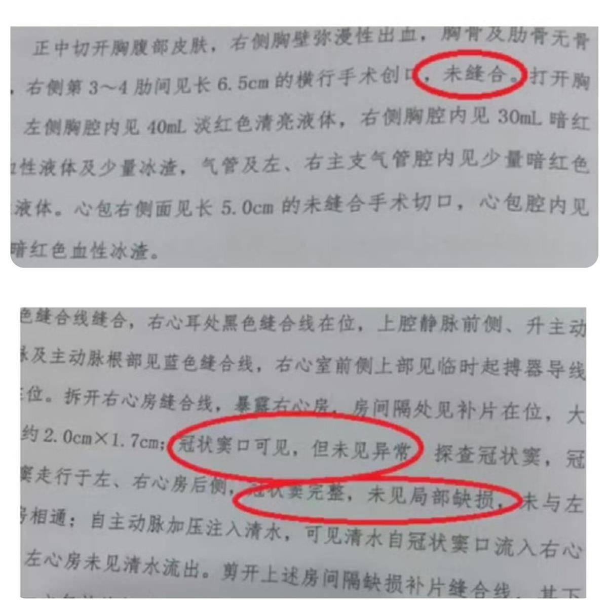 怎么开通皇冠信用网口_宁波夭折女婴小洛熙部分尸检报告公布怎么开通皇冠信用网口,显示6.5厘米创口未缝合,父亲:会择期公布完整报告
